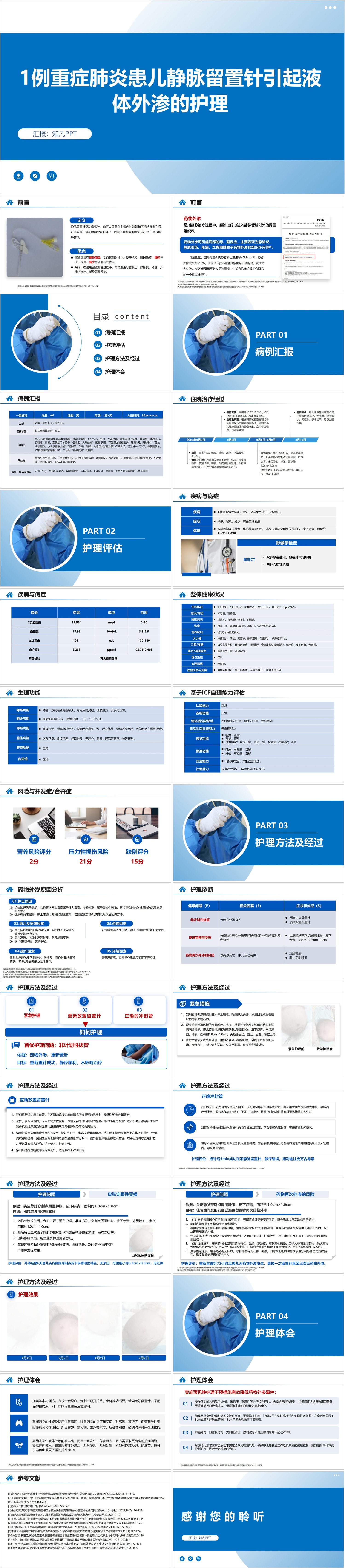 YXKJ113-1例重症肺炎患儿静脉留置针引起液体外渗的护理-个案护理PPT模板成品课件