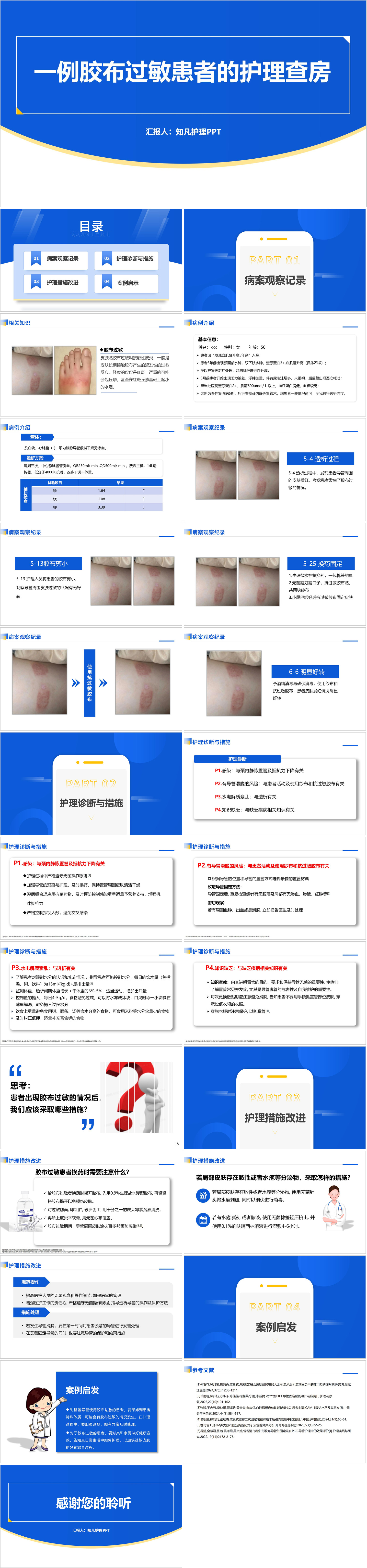 YXKJ938-一例胶布过敏患者的护理查房-护理查房PPT模板成品课件