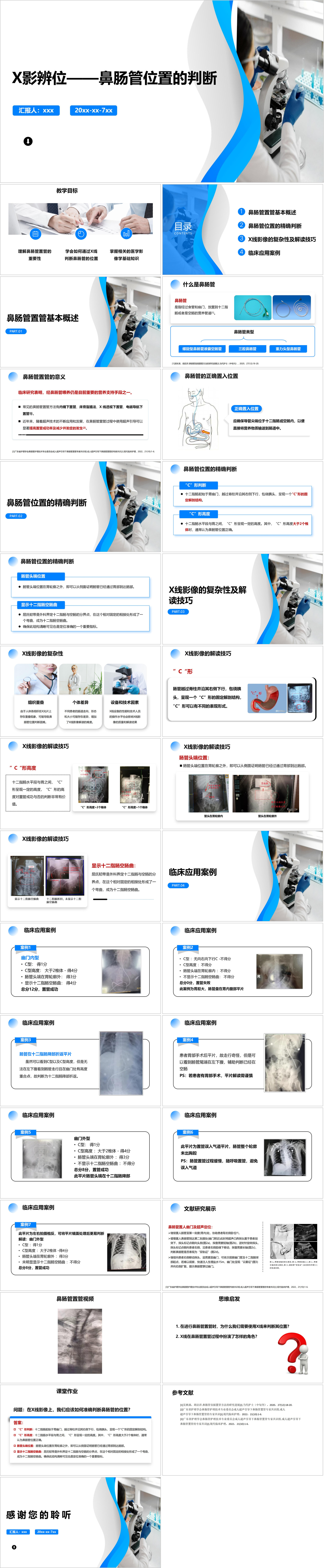YXKJ94-X影辨位——鼻肠管位置的判断-小讲课PPT模板成品课件